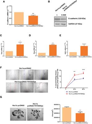 Corrigendum: FXYD5/Dysadherin, a biomarker of endometrial cancer myometrial invasion and aggressiveness: its relationship with TGF-β1 and NF-κB pathways